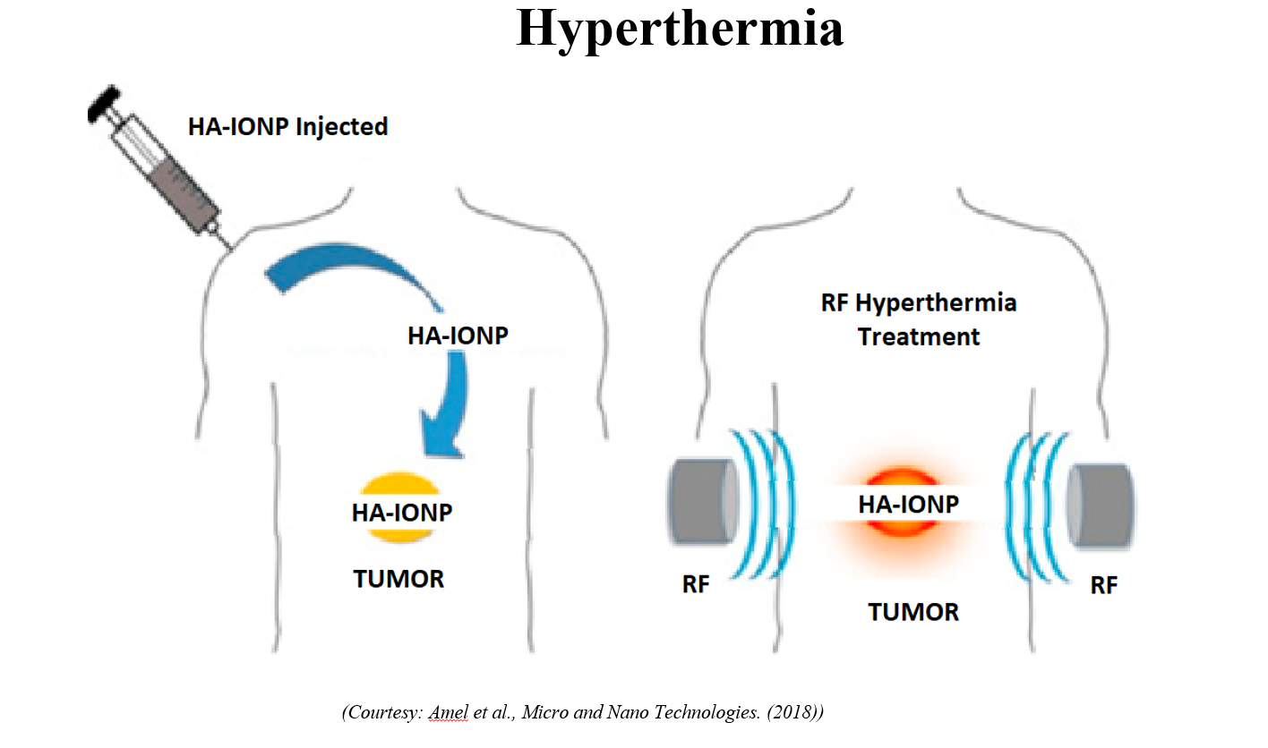 Development of Iron-Based Nanoparticles for Hyperthermia